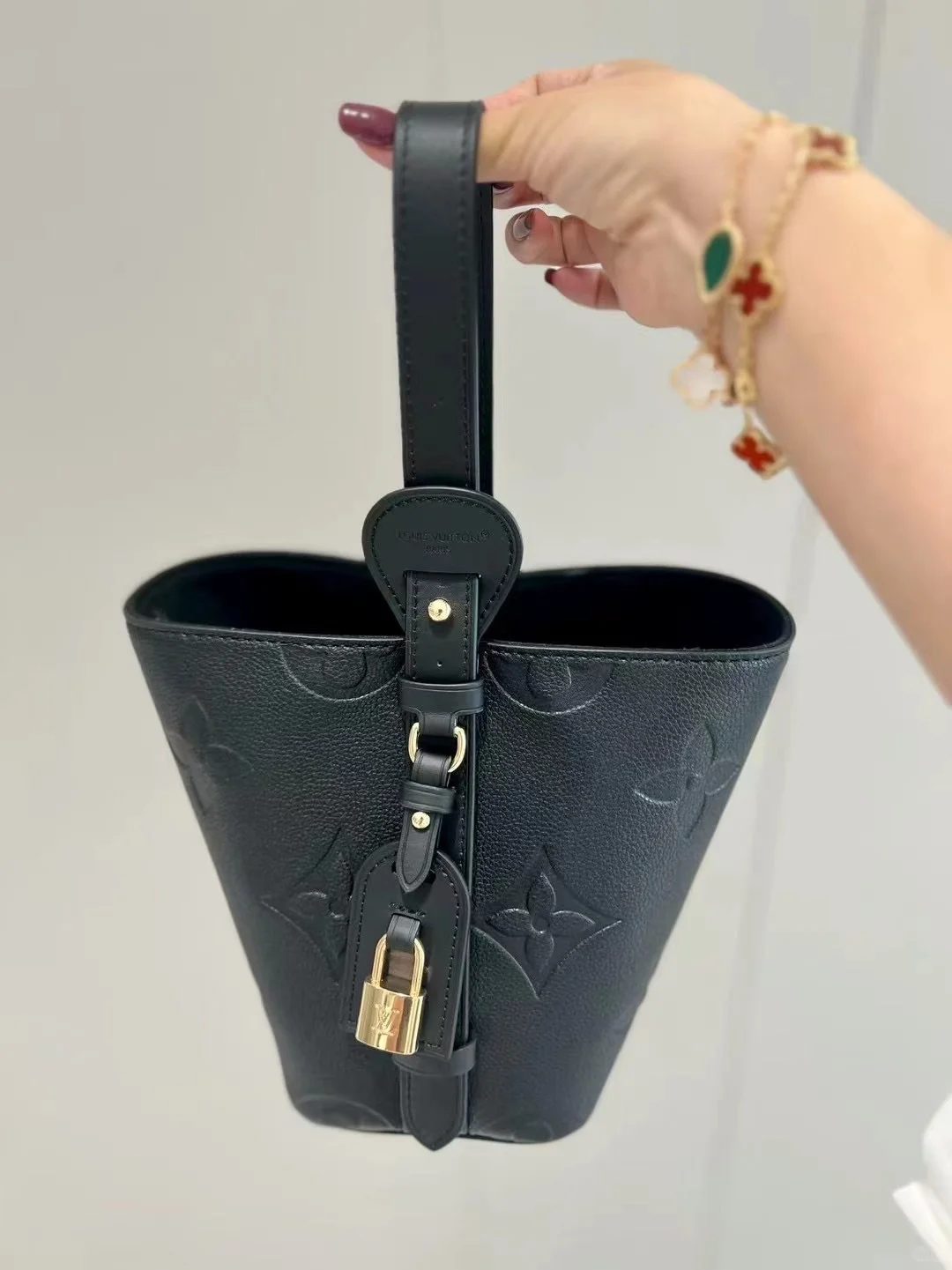 石家庄哪里可以基因检测验血