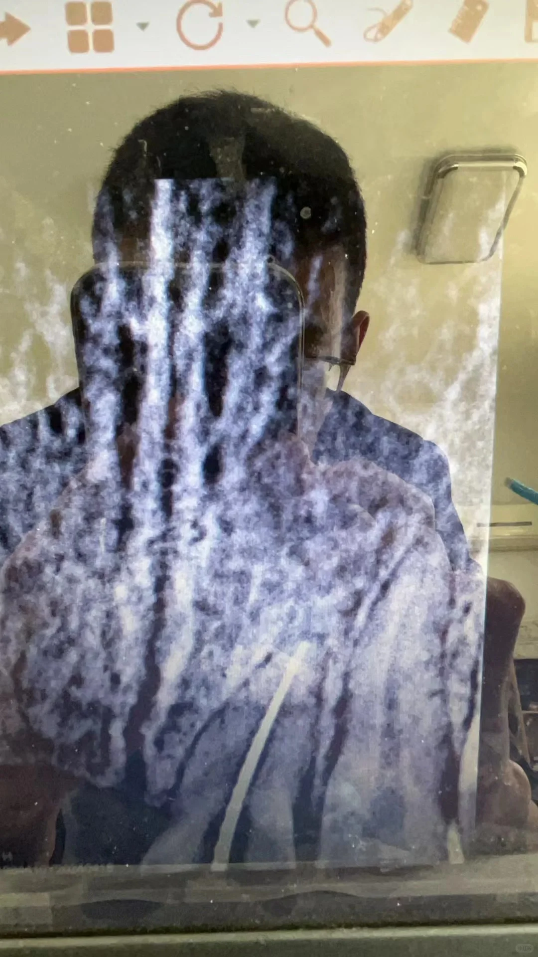 根管治疗之，9年的森田根测仪