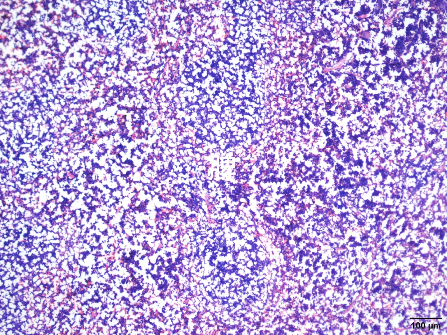 心肝脾肺肾肿瘤HE染色