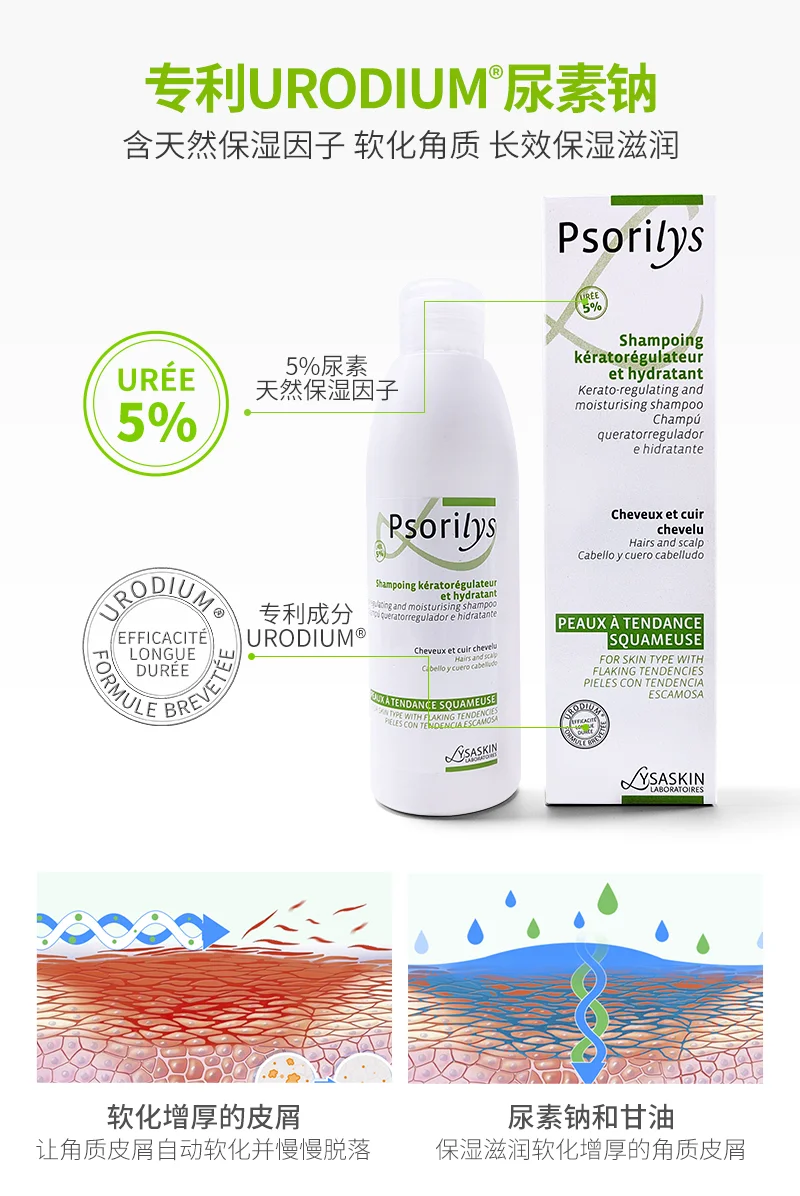 ?头皮银屑病，困扰何时休？