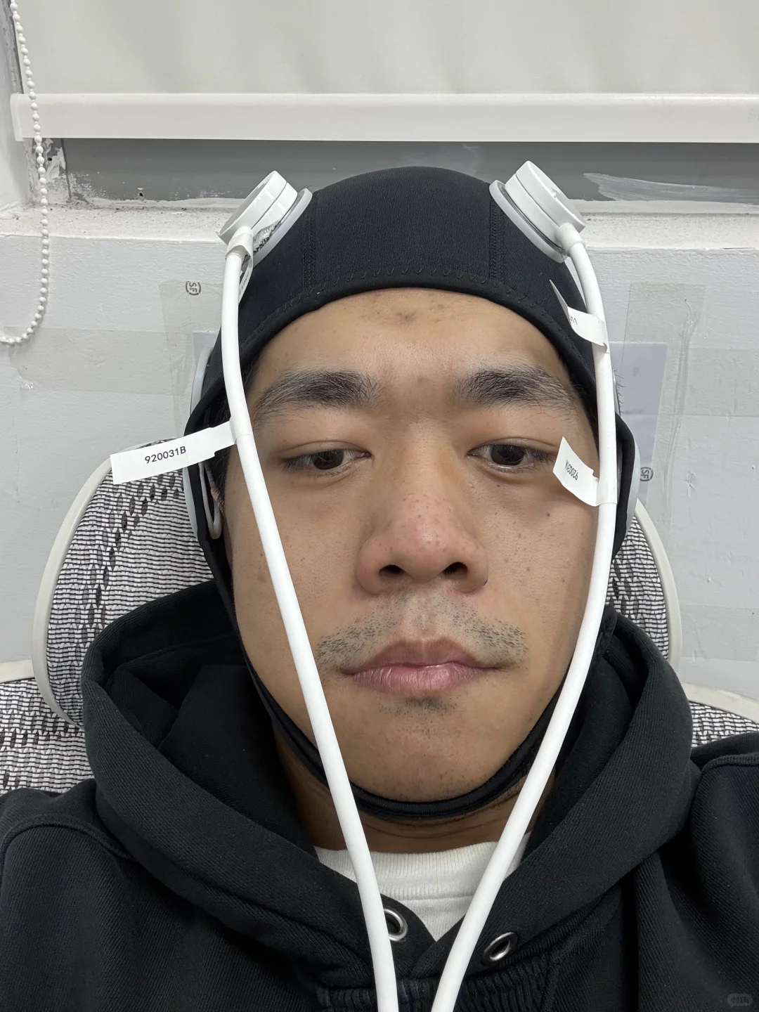 超声脑机接口！！优势和不足