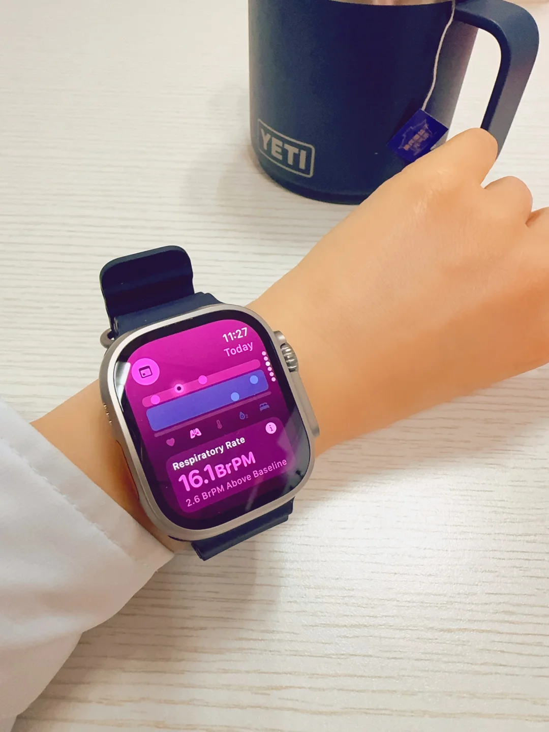 自从发现我发烧了，我的手表很怕我噶了