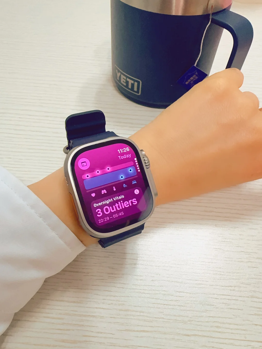 自从发现我发烧了，我的手表很怕我噶了