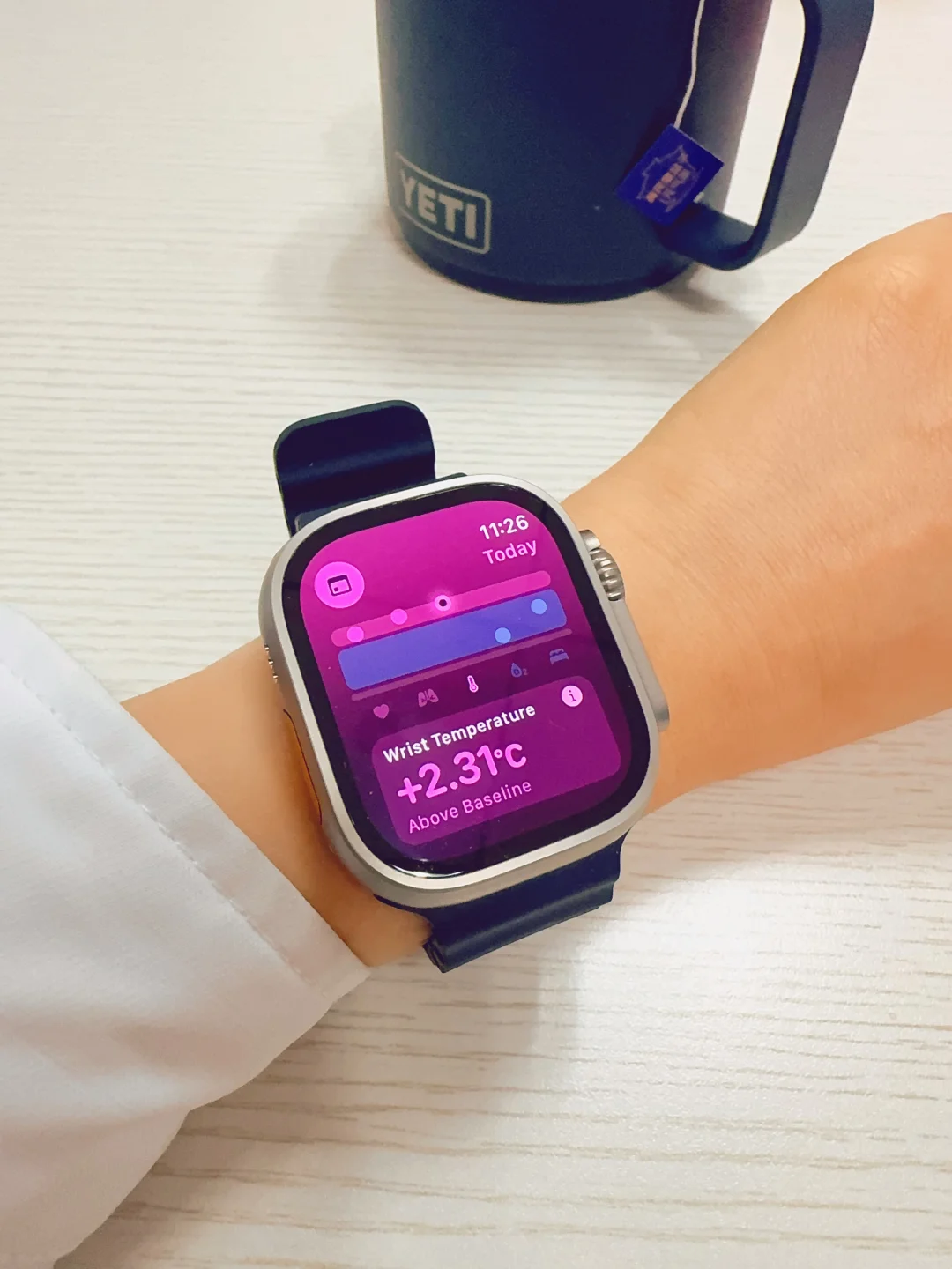 自从发现我发烧了，我的手表很怕我噶了