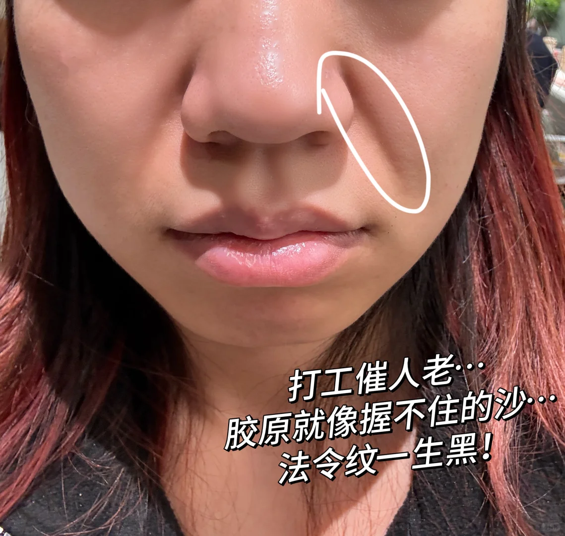 紧懵了‼️不愧是3r断货王！（法令纹必看）