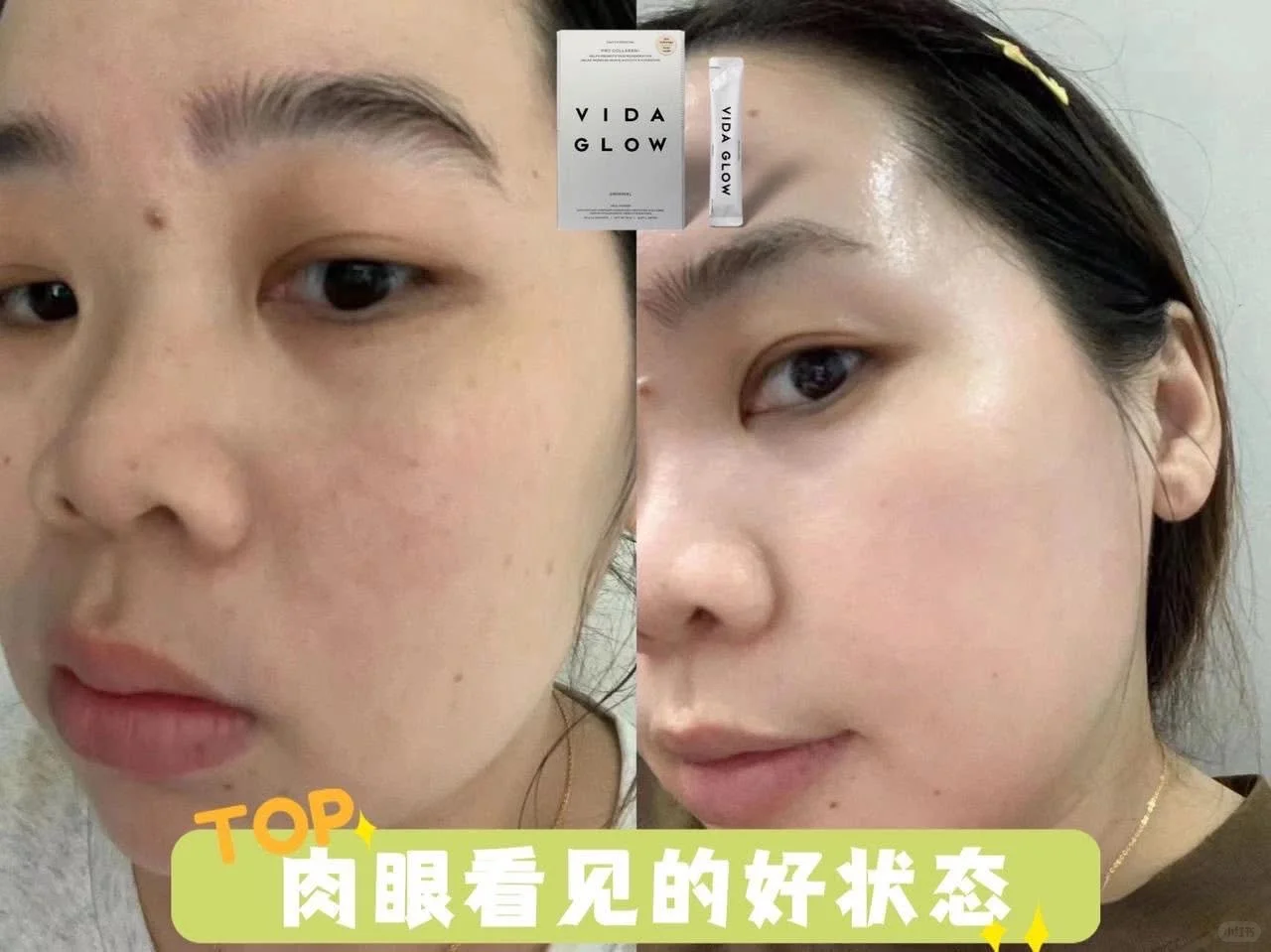 Vida Glow经典海洋胶原蛋白