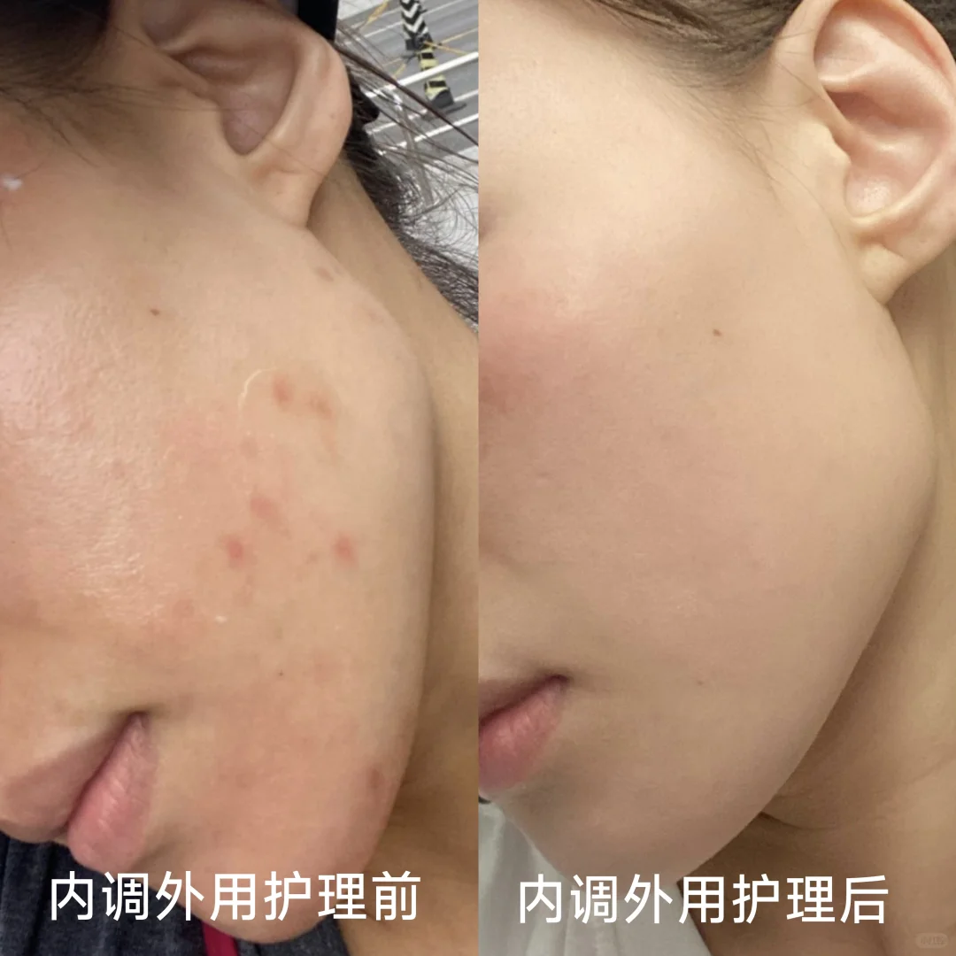 口服胶原蛋白是不是智商税？