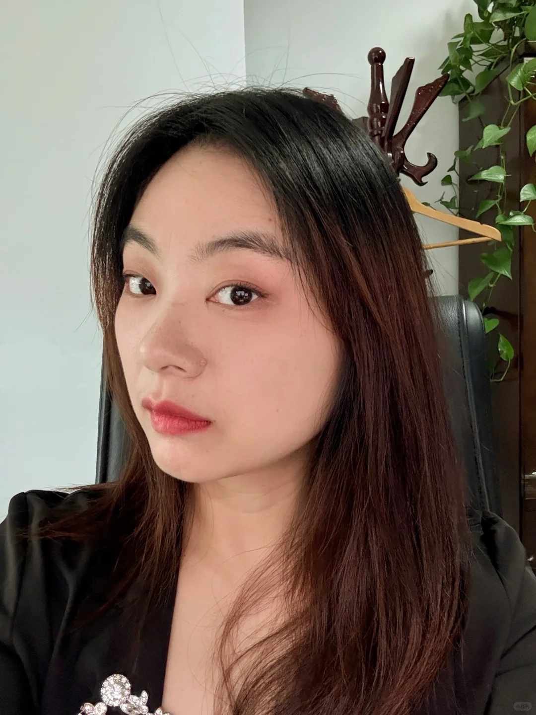 泪沟凹陷打了一支胶原蛋白，效果确实不一样