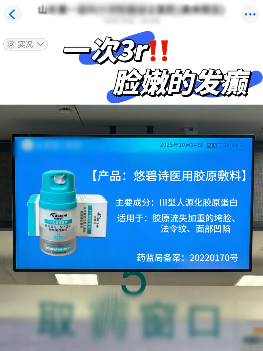 紧懵了‼️不愧是3r断货王！（法令纹必看）