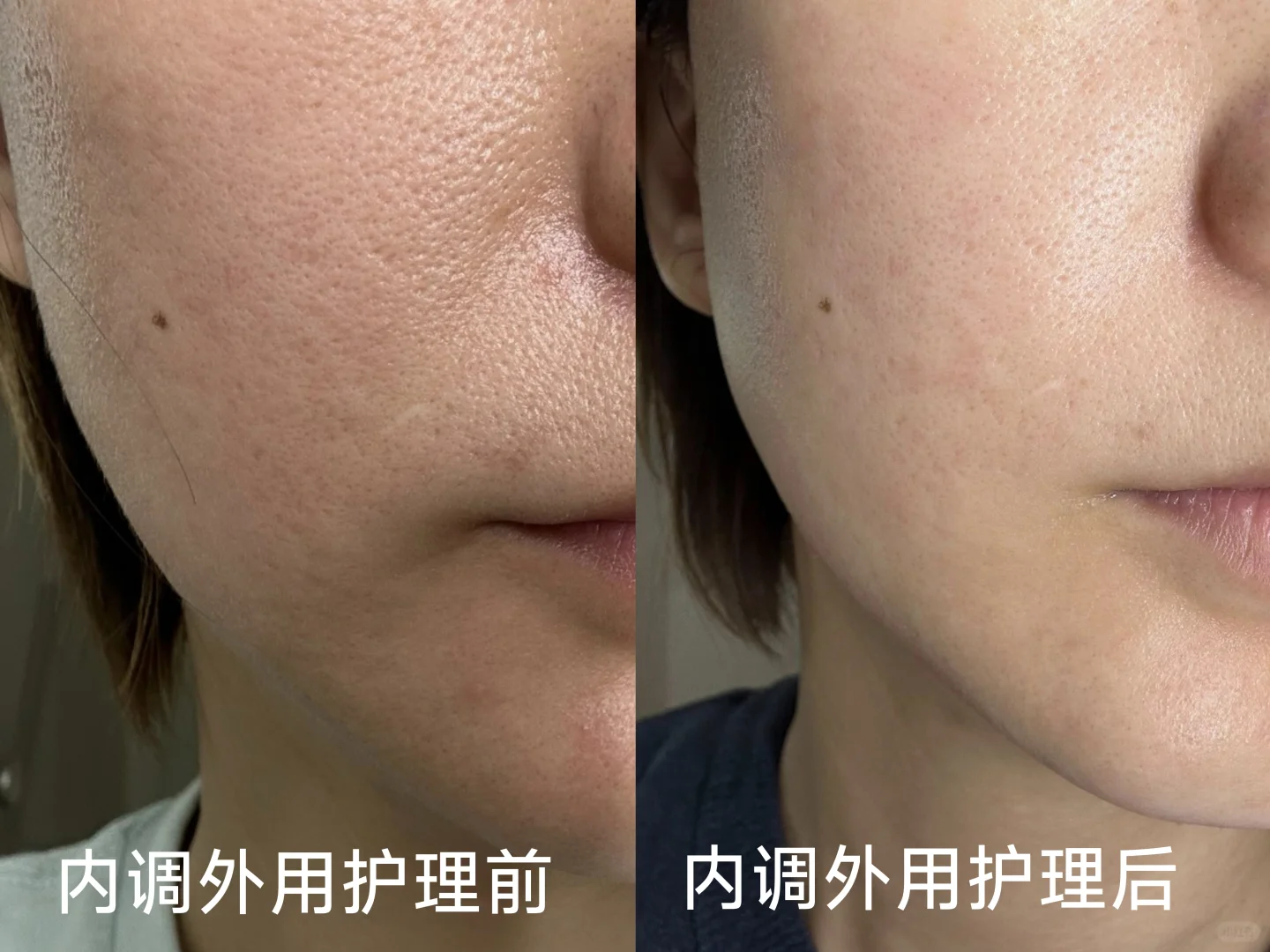 口服胶原蛋白是不是智商税？