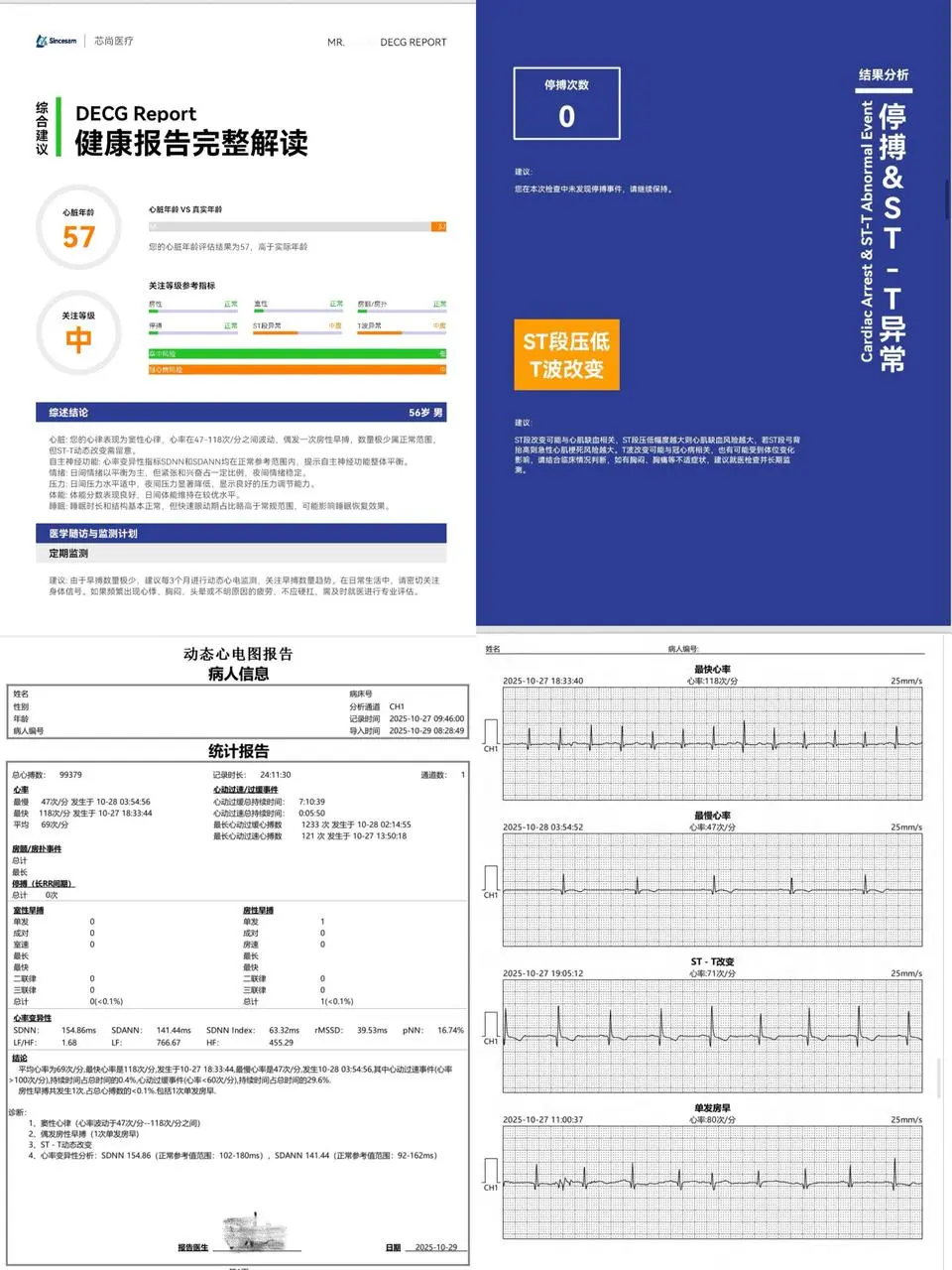 给爸妈买智能监测设备别瞎选!认准翳用级
