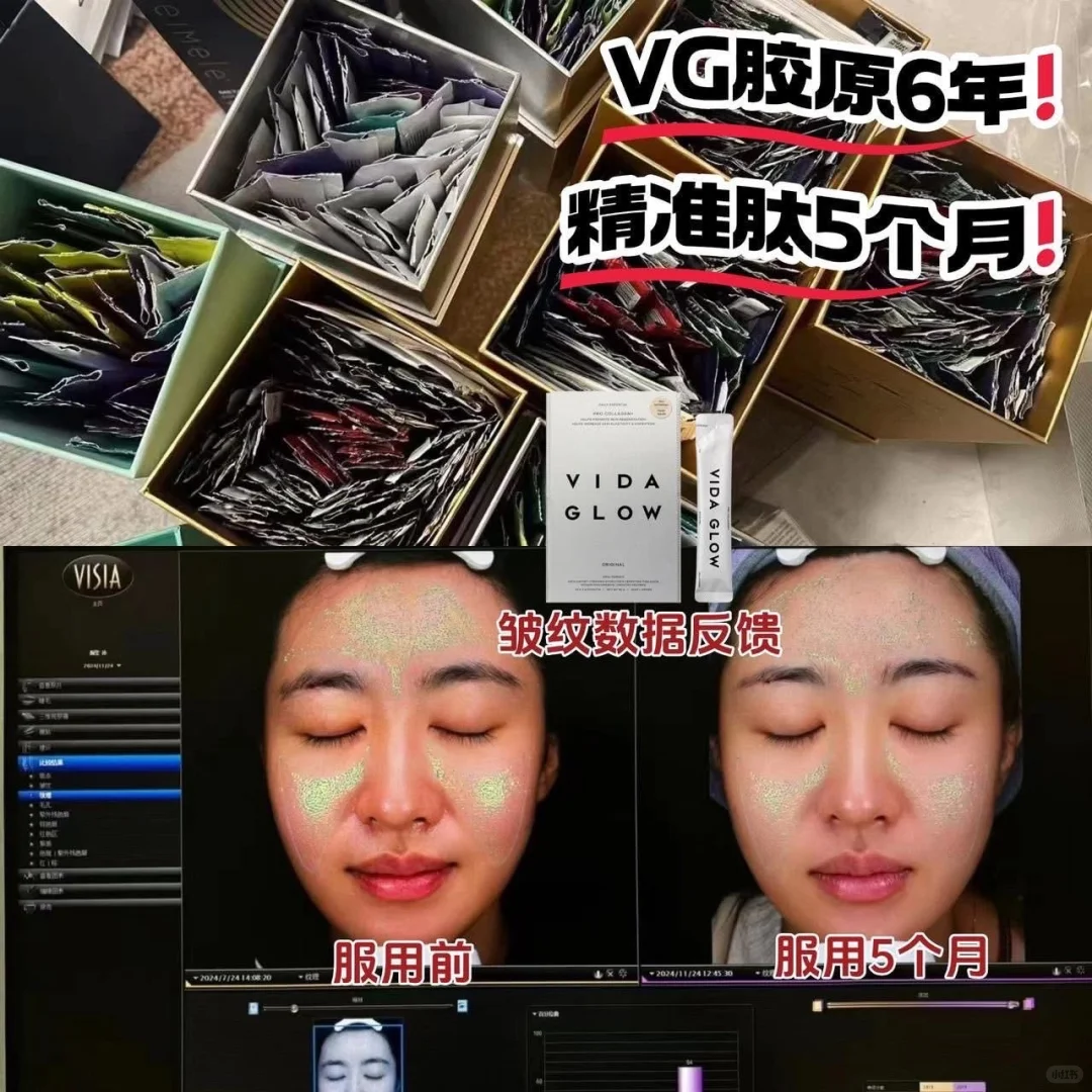 Vida Glow经典海洋胶原蛋白