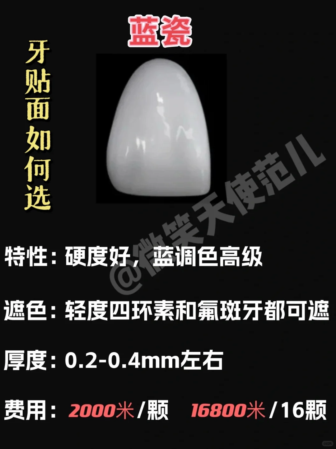 全瓷贴面都是有哪几种？