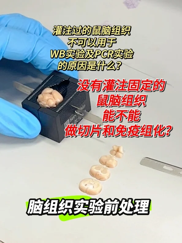 ✨脑组织实验前处理方法全攻略