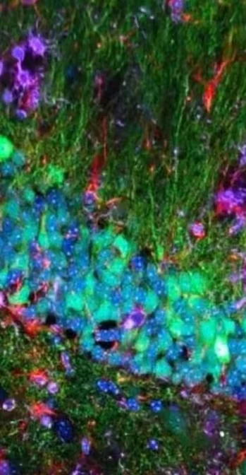 切脑子的说-切脑片protocol