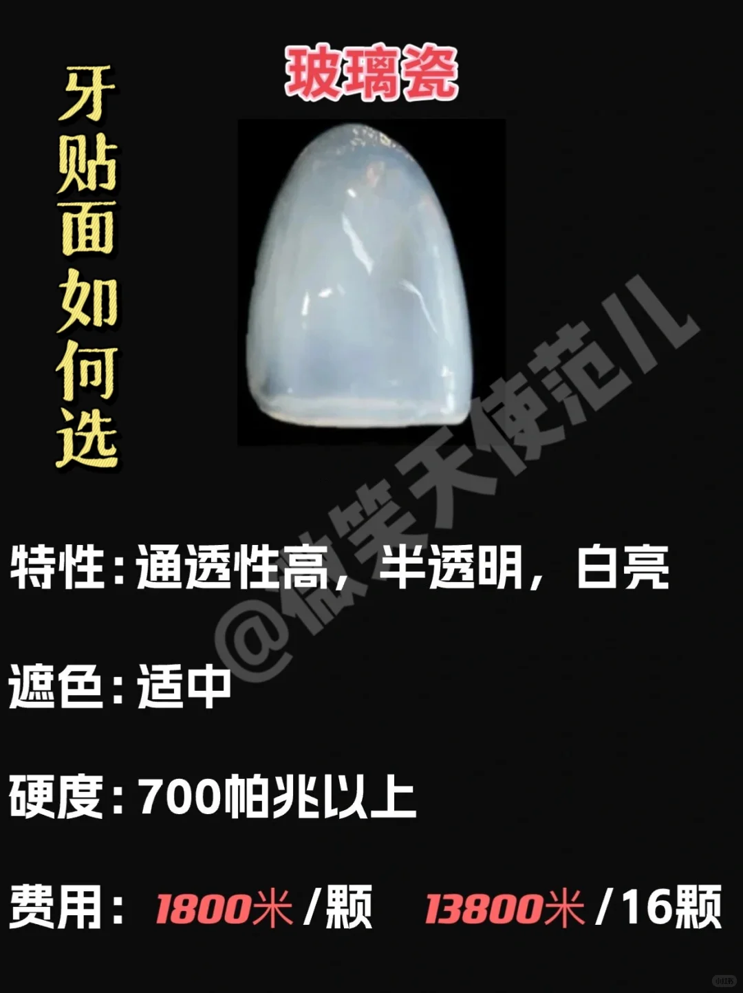 全瓷贴面都是有哪几种？