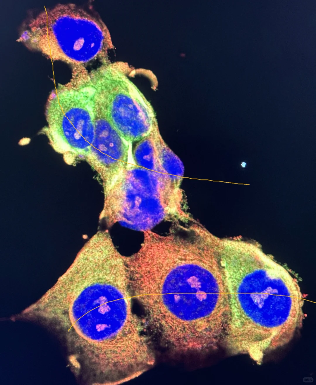 免疫荧光，固定与通透该用什么试剂？
