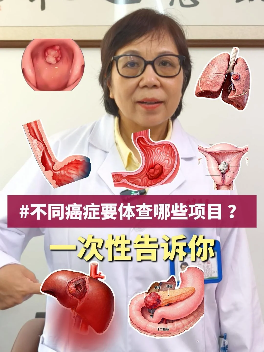 【不同癌症体检查该哪些项目?一篇搞定!】