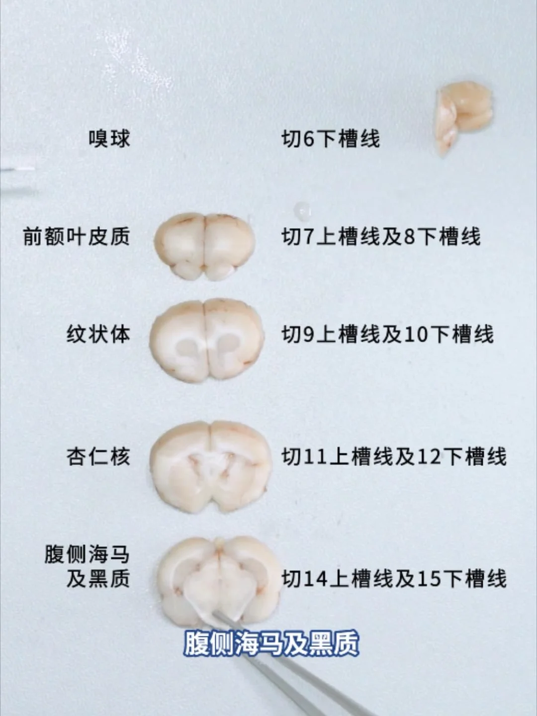 ✨脑组织实验前处理方法全攻略