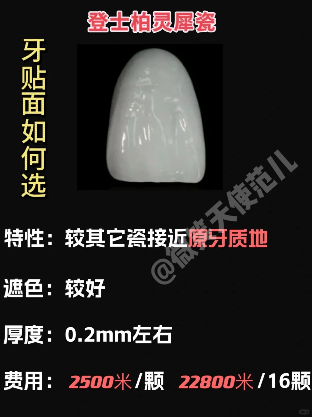 全瓷贴面都是有哪几种？