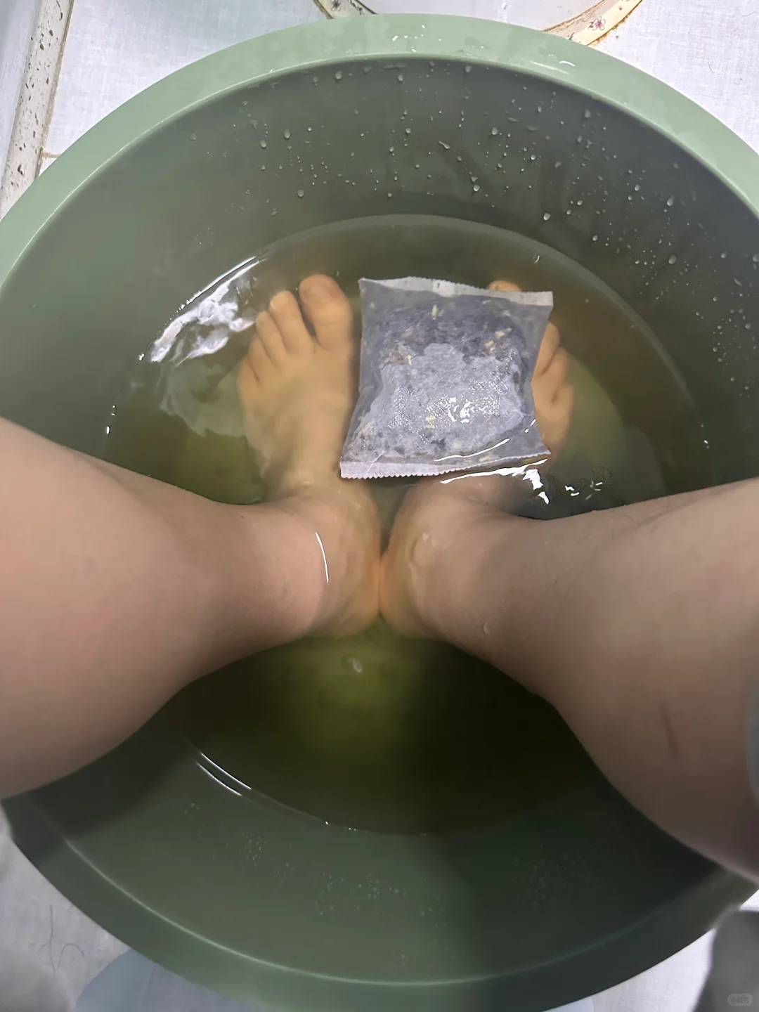 南京备孕? | 子宫异常出血➕孕酮太低❗