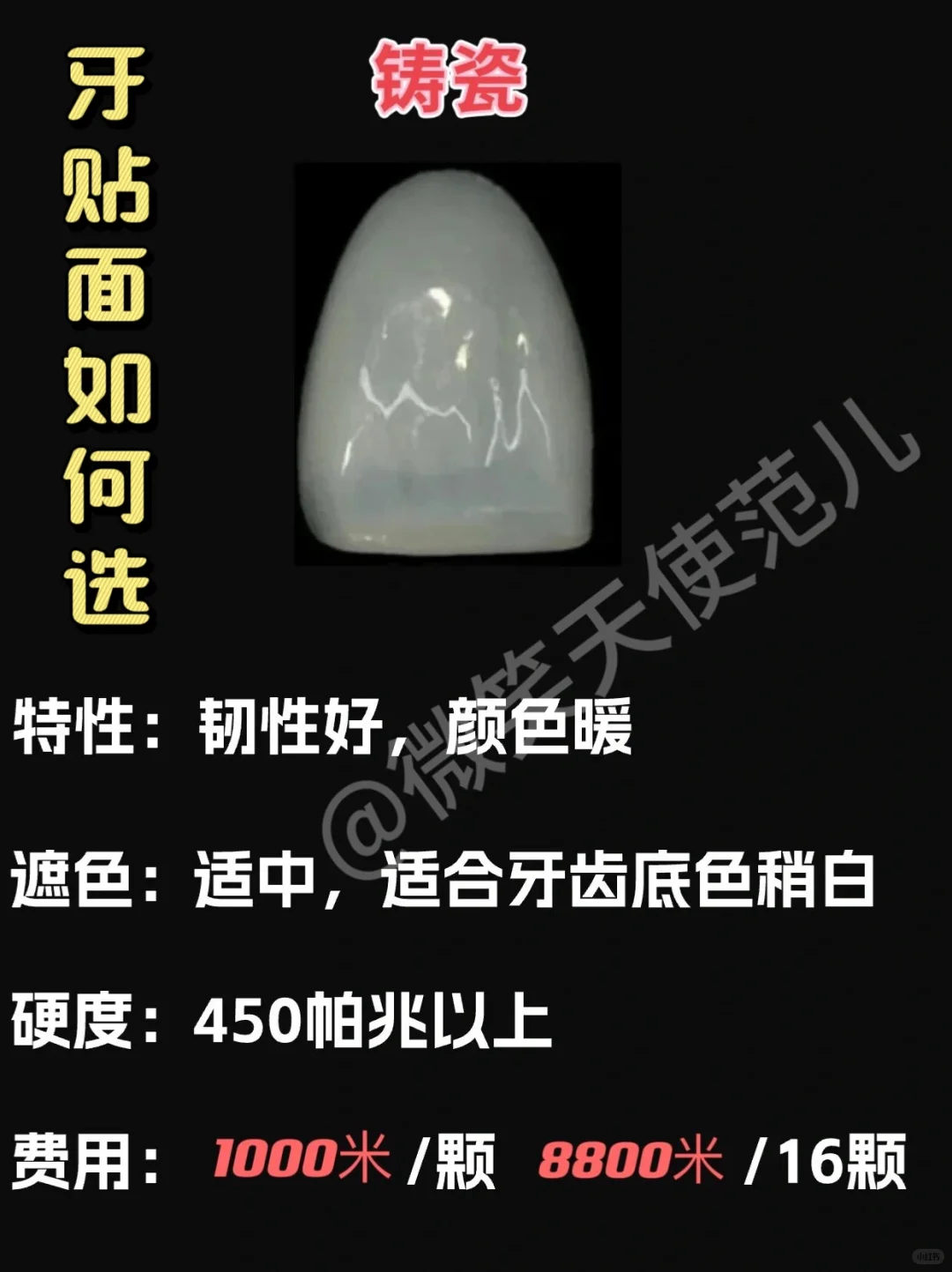 全瓷贴面都是有哪几种？