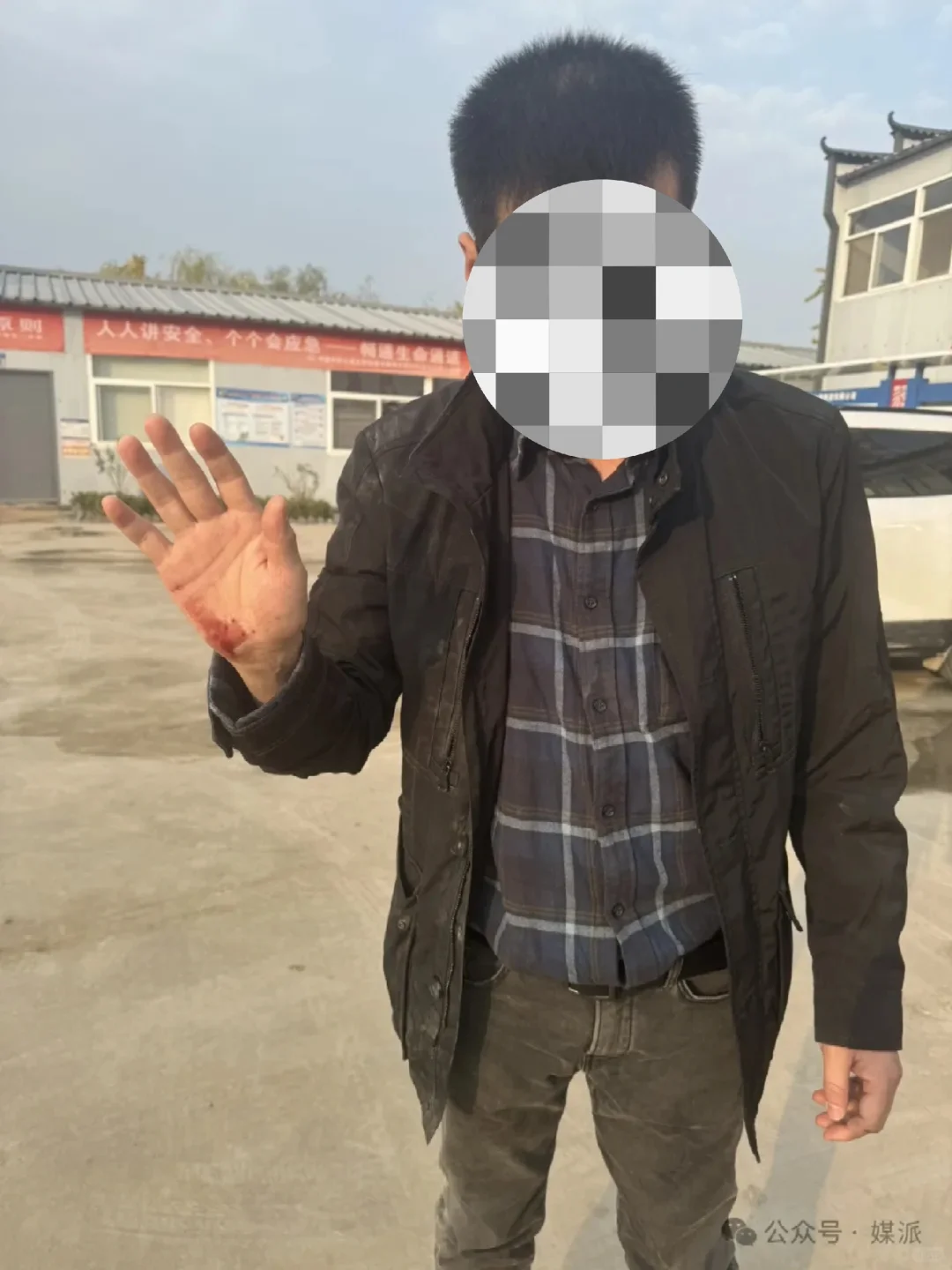 突发！新华社调查记者追访途中被袭击