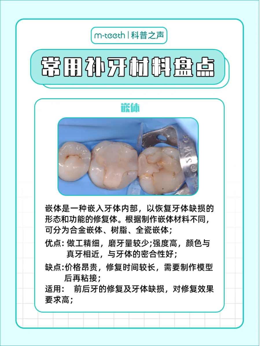 补牙材料怎么选?一篇教你如何选对！