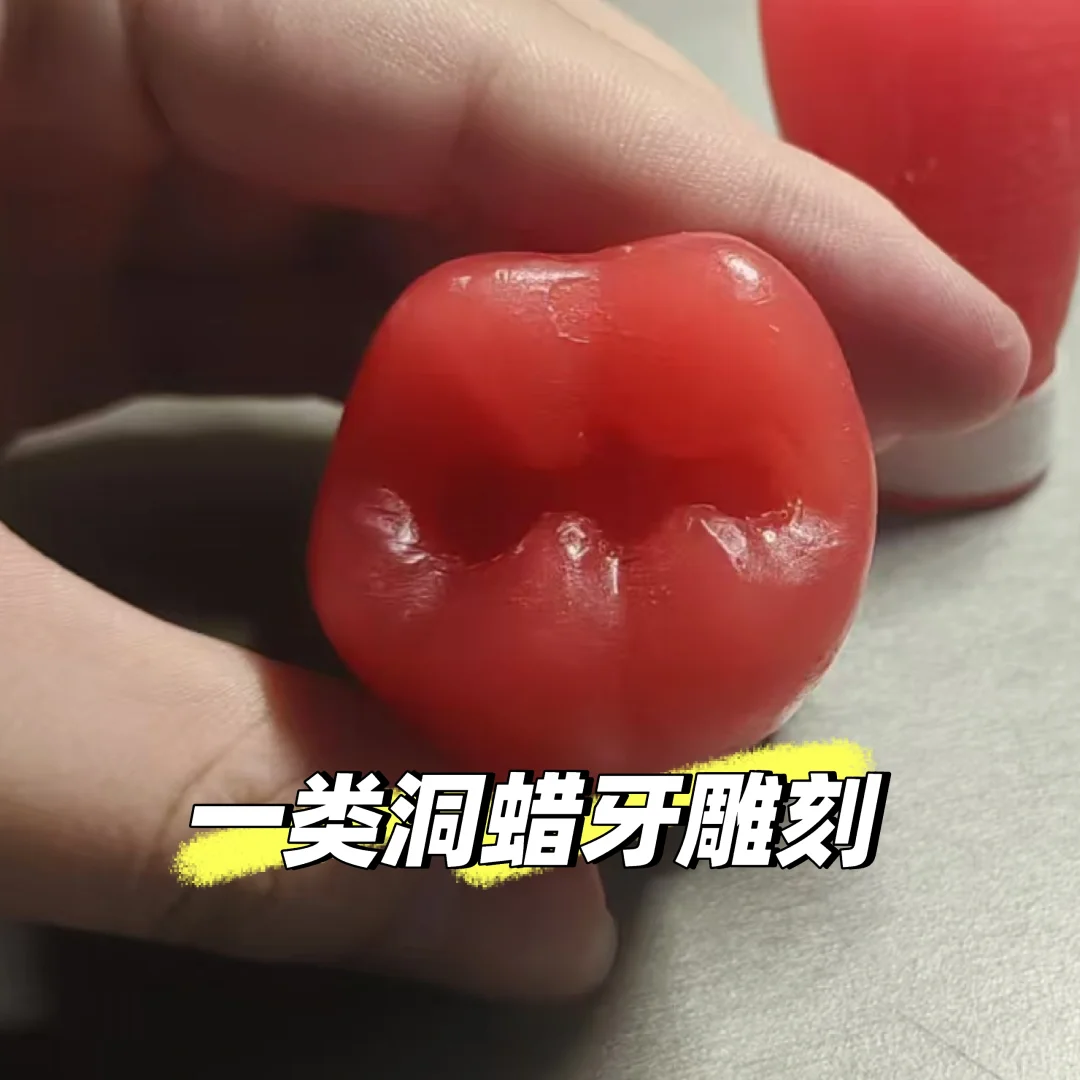 口腔医学实验——窝洞预备与银汞合金充填