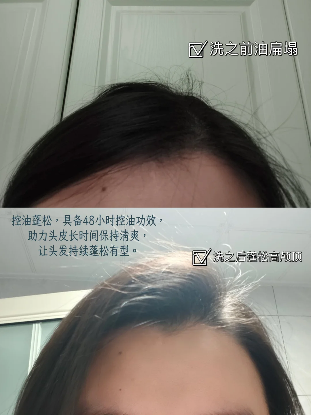 油头救星!这洗发水让我三天不洗头也不塌