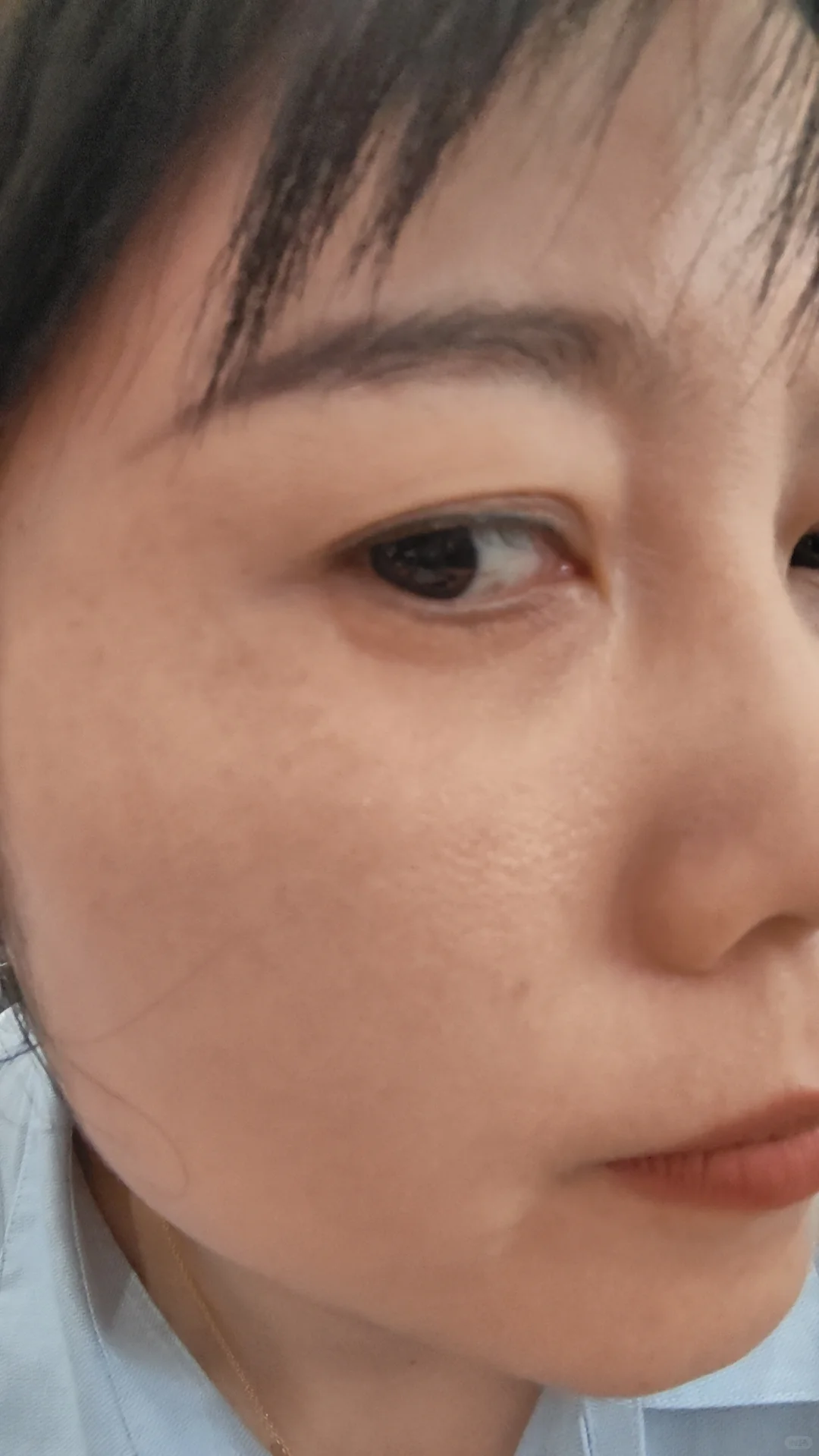 想要淡化黄褐斑的用维c，强推