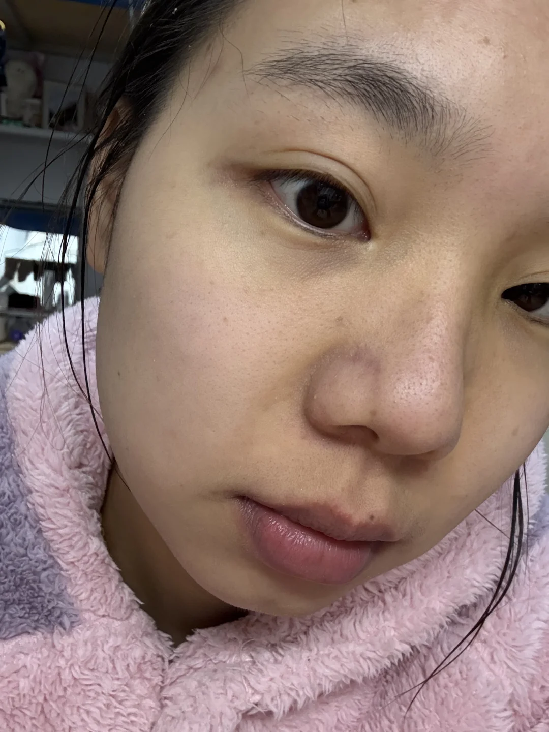 女大学生的护肤日记、坚持打卡酸c护肤