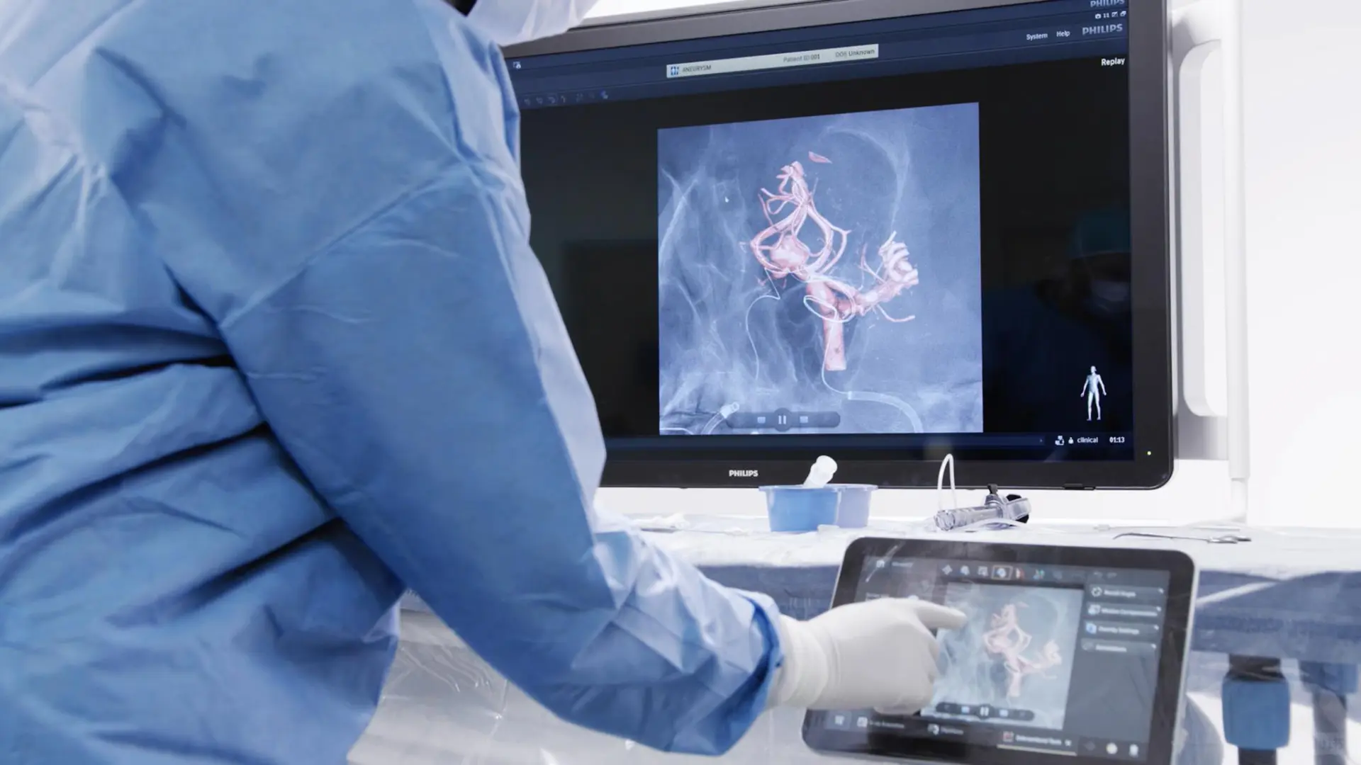 2025IF金奖,Philips神经手术双C臂设计