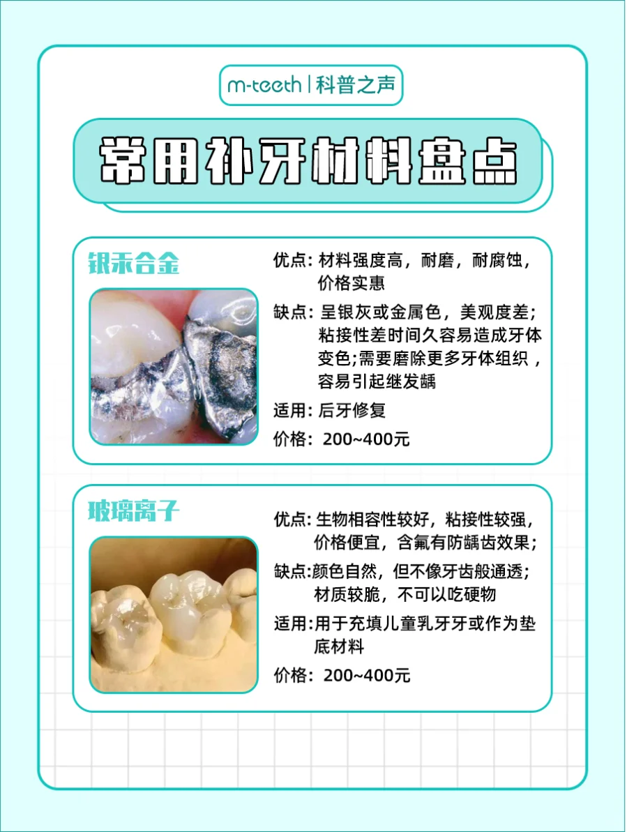 补牙材料怎么选?一篇教你如何选对！