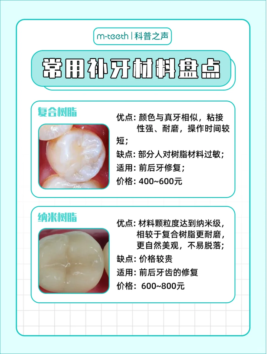 补牙材料怎么选?一篇教你如何选对！