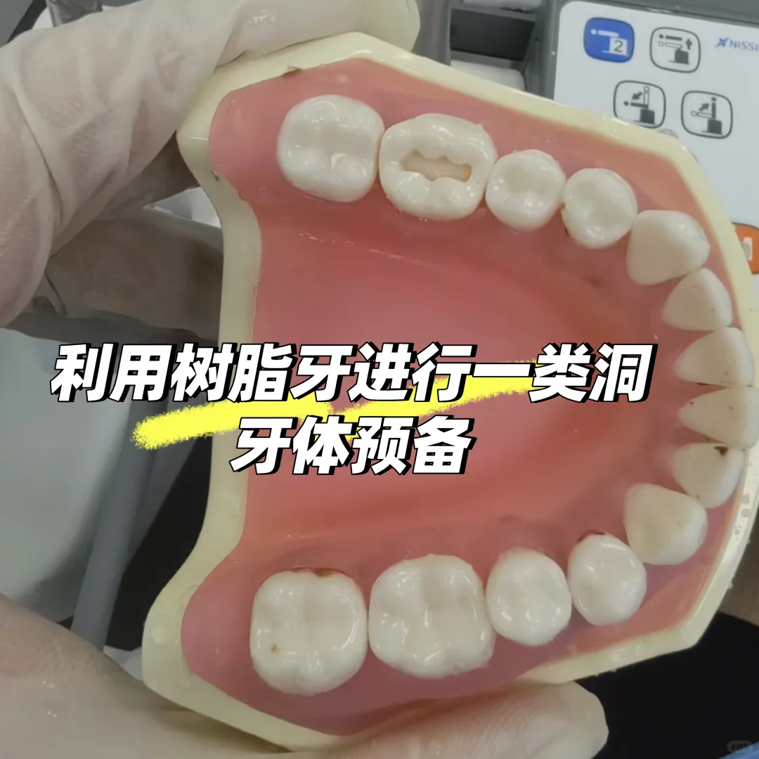 口腔医学实验——窝洞预备与银汞合金充填