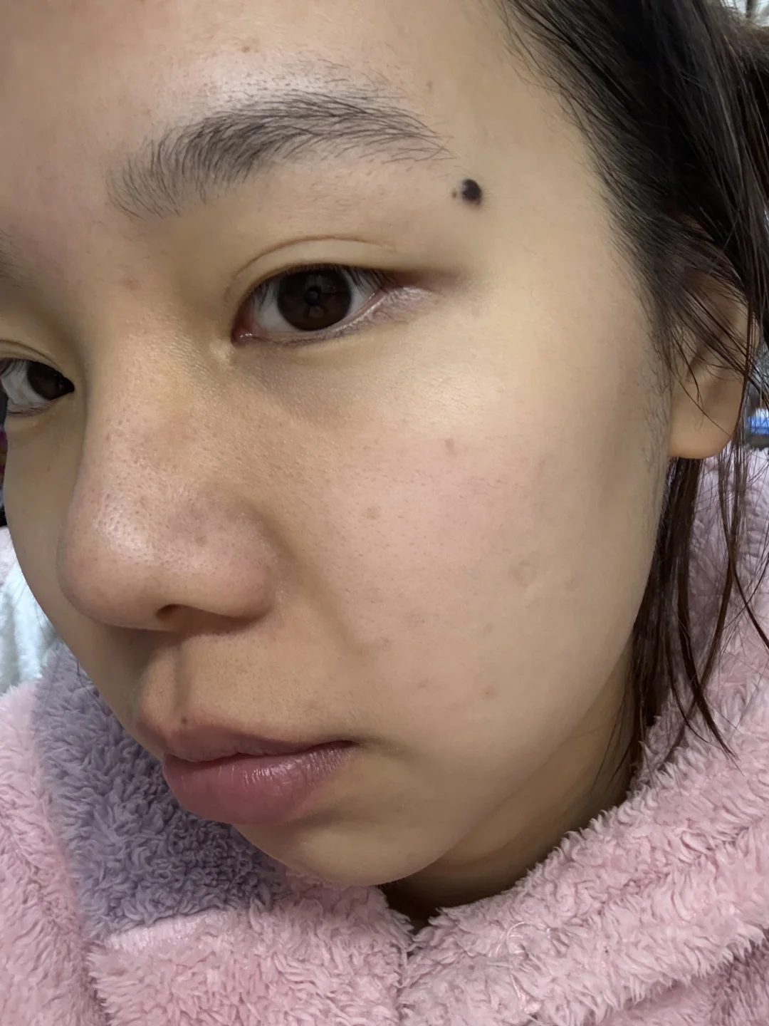 女大学生的护肤日记、坚持打卡酸c护肤