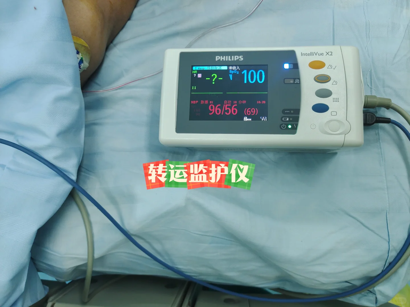 小巧玲珑惹人爱