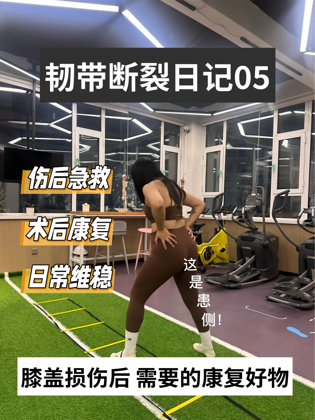 术后康复日记5: 分享运动人的康复装备?