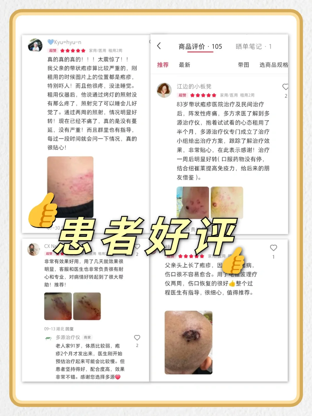 带状疱疹遇上多源?真的是捡到宝了?