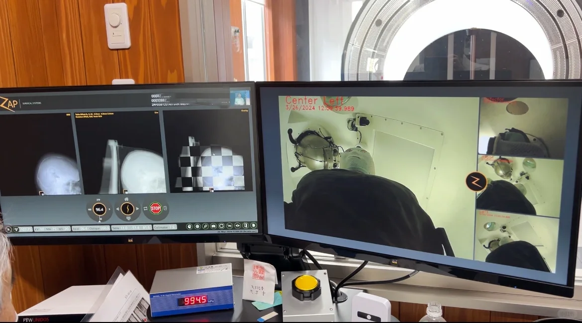 医疗翻译?脑肿瘤陪诊