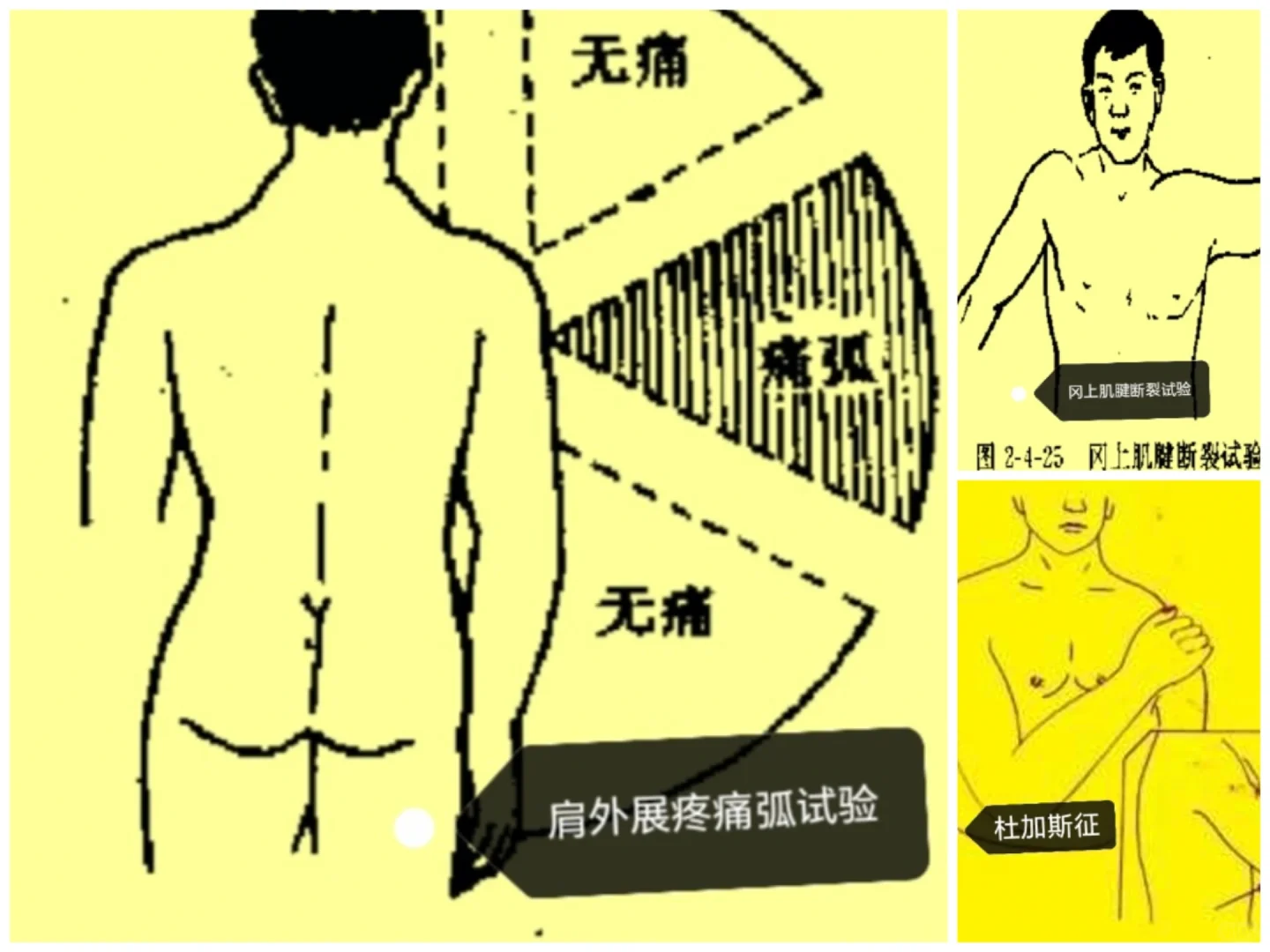 特殊检查相关试验