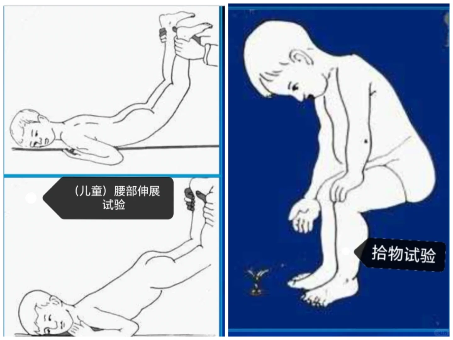 特殊检查相关试验