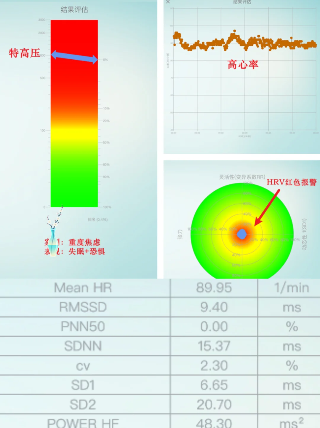 普通人也可以拥有火眼金睛，照见压力大小