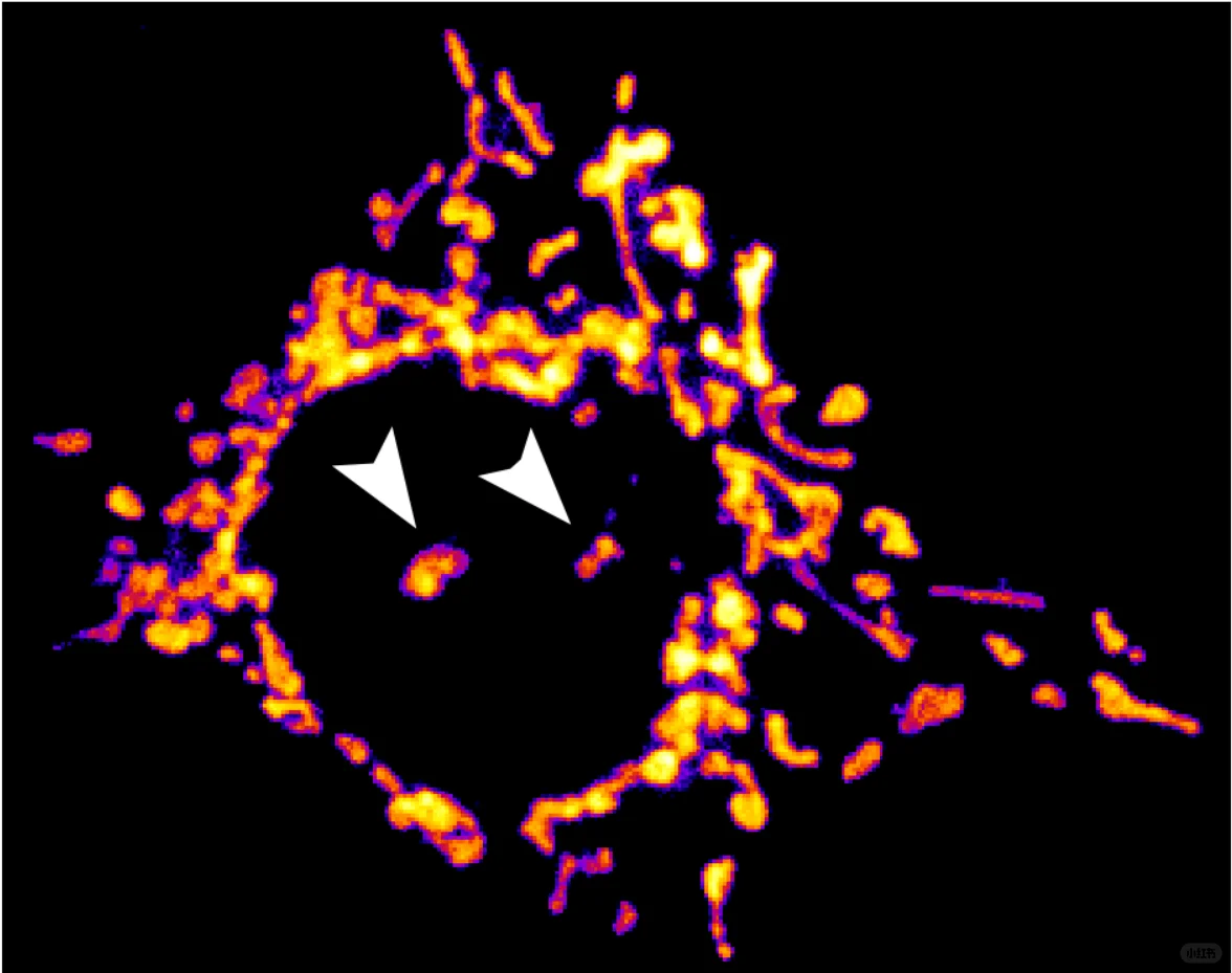 智能荧光显微分析仪能否PK共聚焦显微镜？！