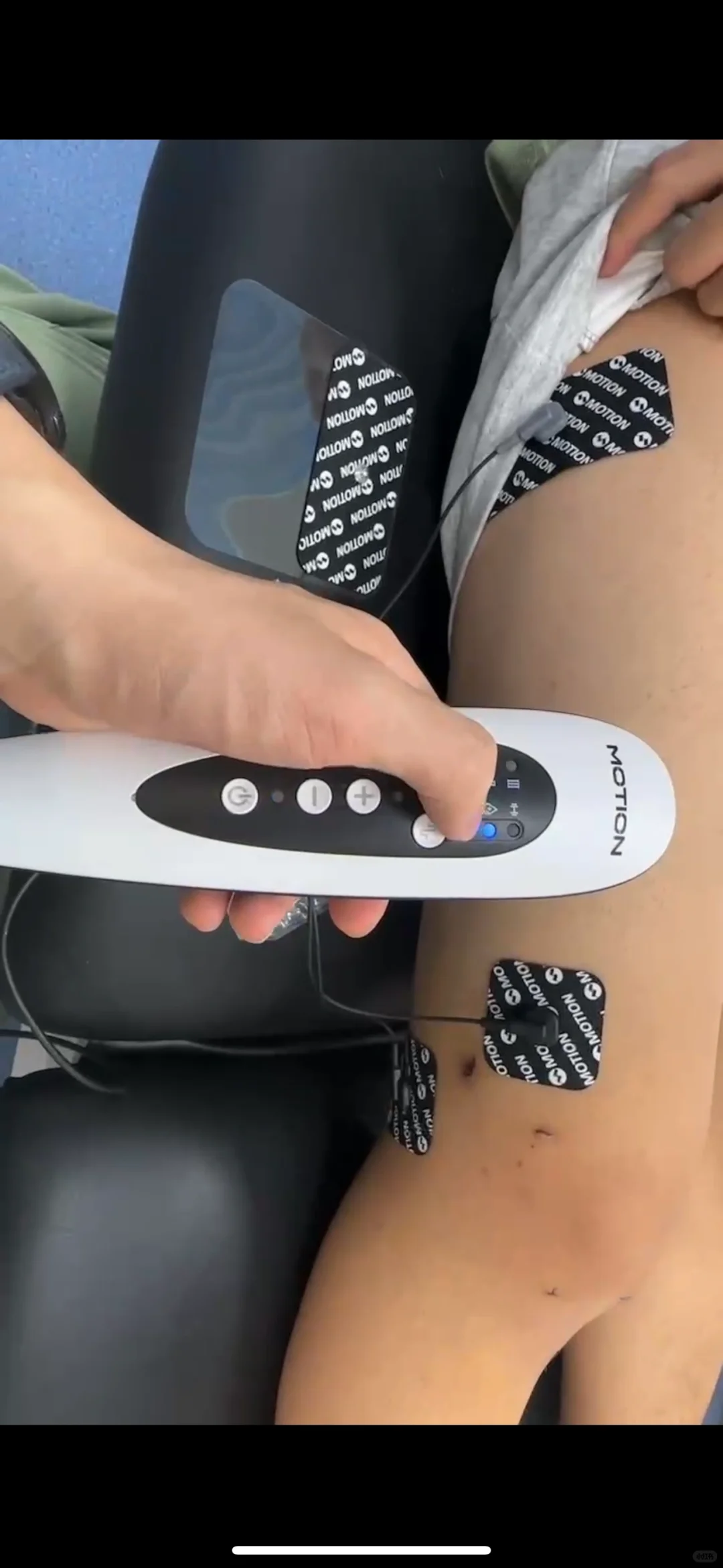 巨巨巨巨好用的便携式超声⭐️