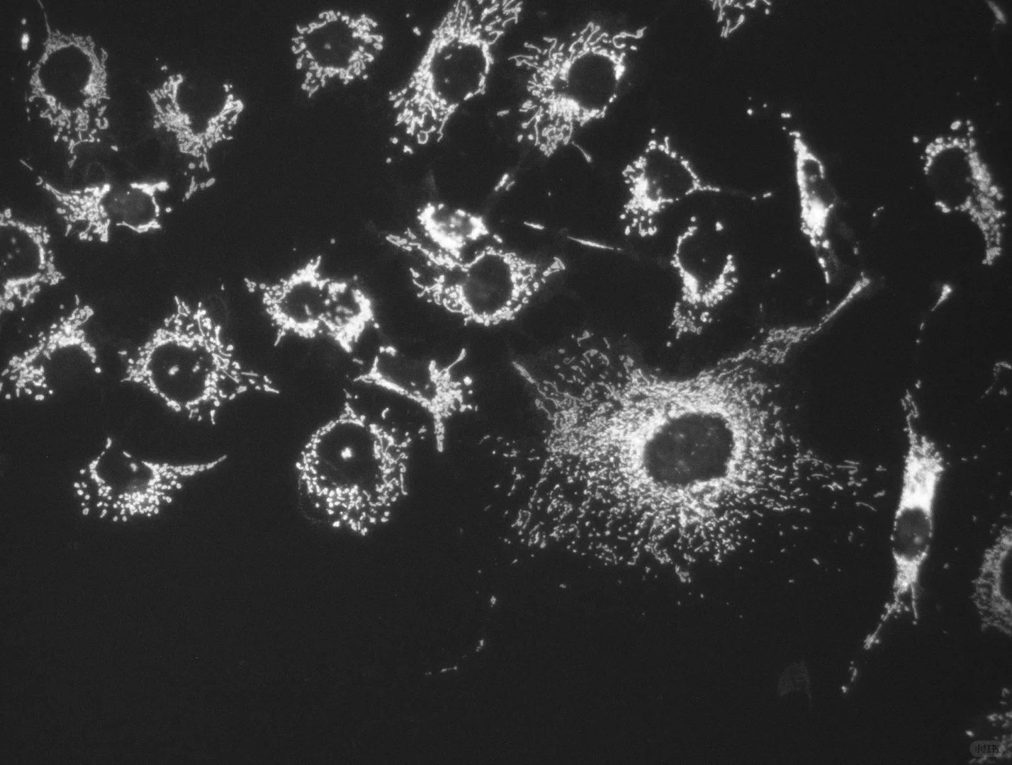 智能荧光显微分析仪能否PK共聚焦显微镜？！