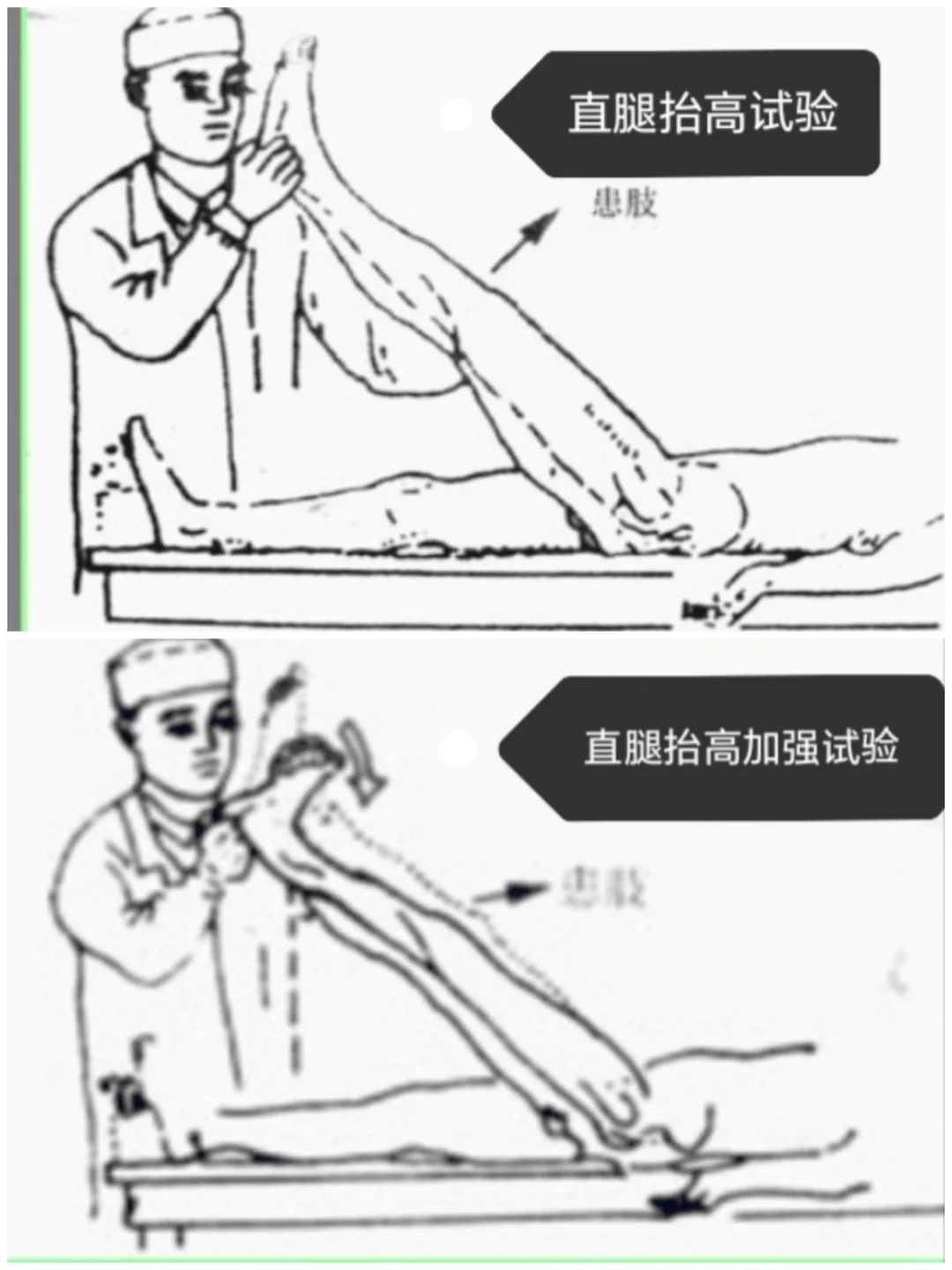 特殊检查相关试验