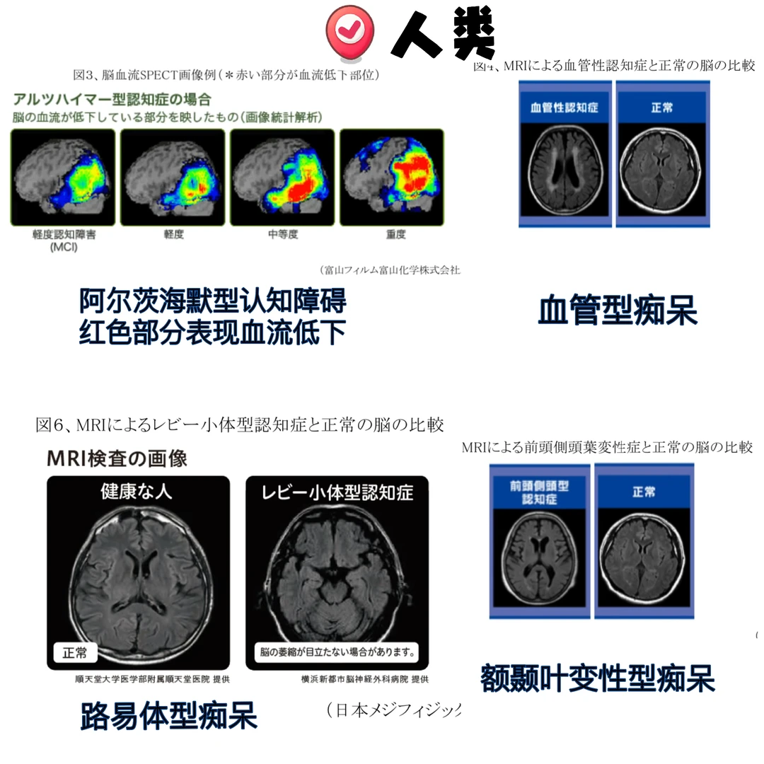 高龄动物的缓和护理——老年痴呆