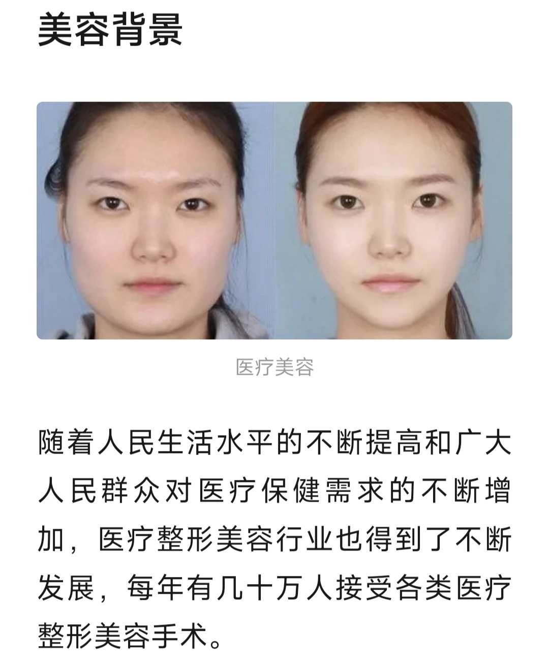 普通人了解医美，看这篇就够了。